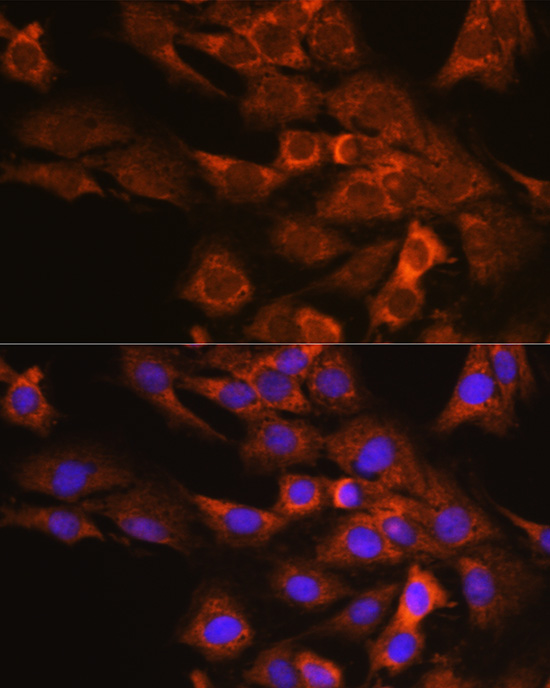 Anti-EIF4G2 Antibody (CAB2897)