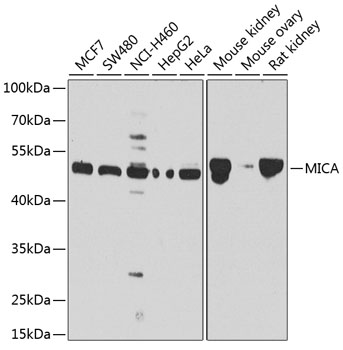 Anti-MICA Antibody (CAB1390)