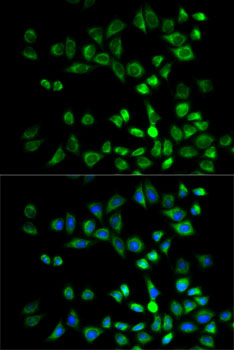 Anti-PSMD10 Antibody (CAB1949)