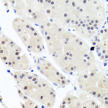 Anti-HNRNPCL1 Polyclonal Antibody (CAB8606)