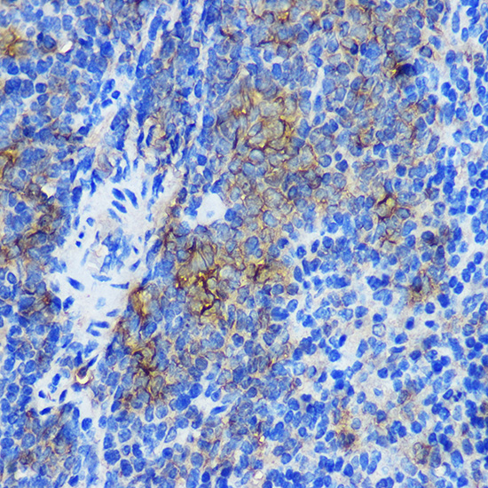 Anti-STAT4 Antibody (CAB2638)