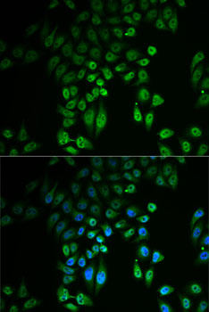 Anti-GPLD1 Antibody (CAB6612)