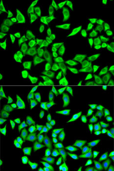 Anti-ROCK2 Antibody (CAB5698)