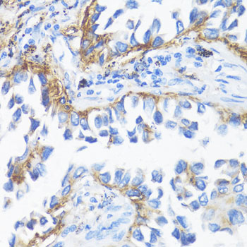 Anti-HLA-DRB3 Antibody (CAB1611)