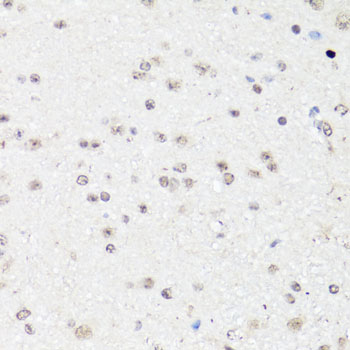 Anti-c-Fos Antibody (CAB2444)