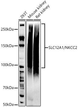 Western blot analysis of extracts of various cell lines, using SLC12A1/NKCC2 antibody at 1:1000 dilution. Secondary antibody: HRP Goat Anti-Rabbit IgG (H+L) at 1:10000 dilution. Lysates/proteins: 25ug per lane. Blocking buffer: 3% nonfat dry milk in TBST. Detection: ECL Basic Kit. Exposure time: 60s.