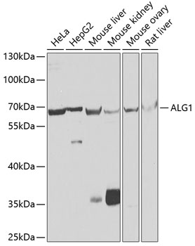 Anti-ALG1 Antibody (CAB7818)