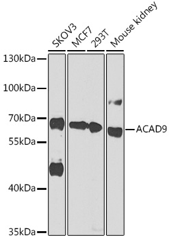 Anti-ACAD9 Antibody (CAB14121)