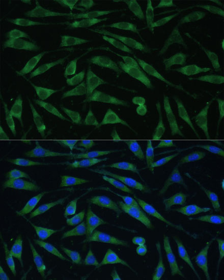 Anti-DNM3 Antibody (CAB15148)