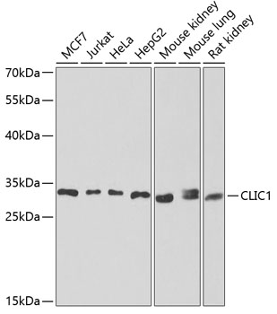 Anti-CLIC1 Antibody (CAB6363)