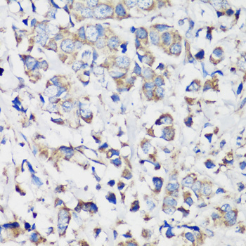 Anti-Cyclin B1 Antibody (CAB16038)