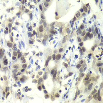 Anti-E2F6 Antibody (CAB2718)
