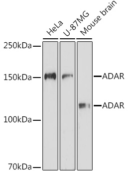 Anti-ADAR Antibody (CAB7869)