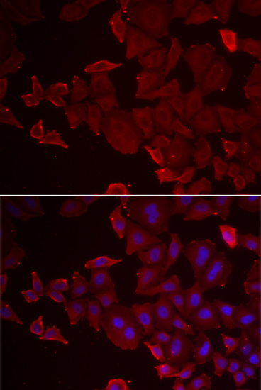 Anti-MARCKSL1 Antibody (CAB7132)