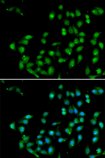 Anti-CTNNBL1 Antibody (CAB6572)