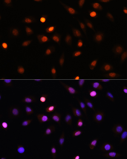 Anti-PRMT1 Antibody (CAB1055)