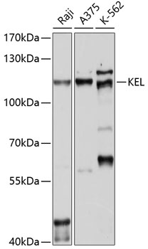 Anti-KEL Antibody (CAB10116)