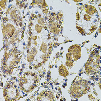 Anti-Cyclin A2 Antibody (CAB2891)