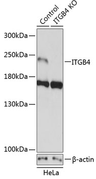 Anti-ITGB4 Antibody [KO Validated] (CAB19890)