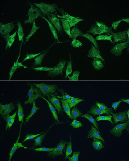 Anti-EZR Antibody (CAB0703)