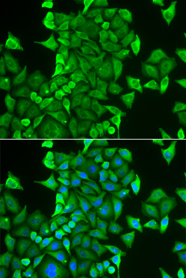 Anti-CARS Antibody (CAB6540)