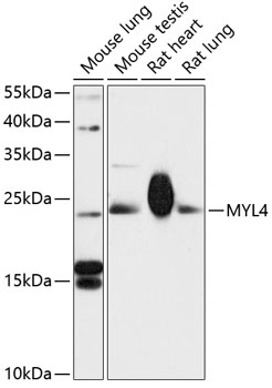 Anti-MYL4 Antibody (CAB13249)