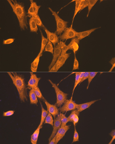 Anti-PFKL Antibody (CAB7708)