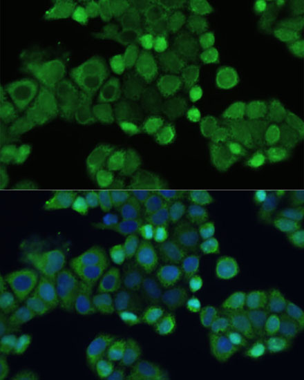 Anti-Smad2 Antibody (CAB11498)