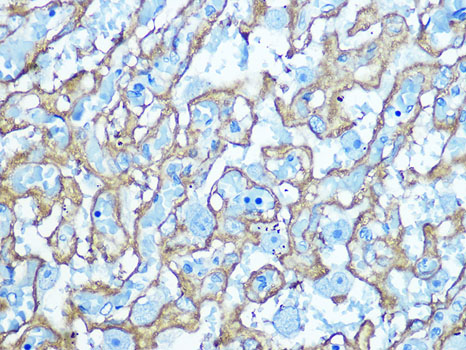 Anti-GLUT1 Antibody (CAB6982)