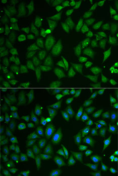 Anti-SCG2 Antibody (CAB6425)