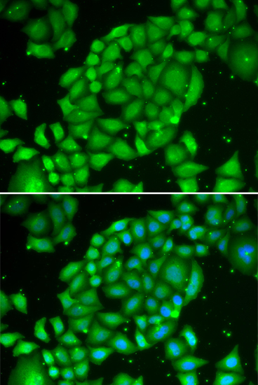 Anti-TCL1A Antibody (CAB0629)