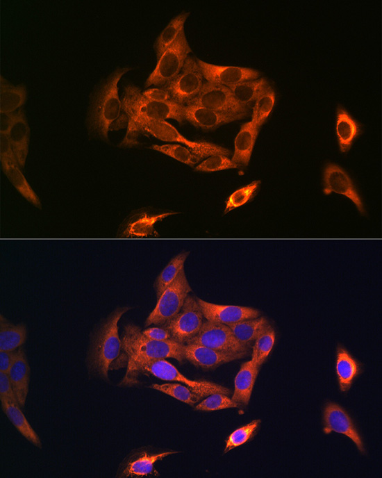 Anti-NOSTRIN Antibody (CAB15938)