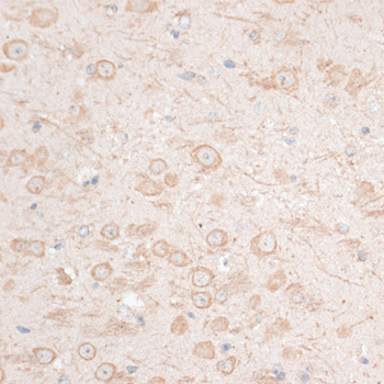 Anti-HMGA1 Antibody (CAB12693)