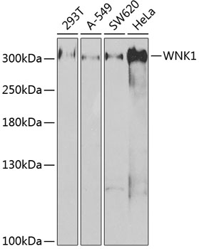 Anti-WNK1 Antibody (CAB2569)