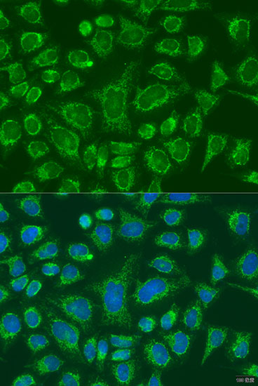 Anti-FCGR3B Antibody (CAB13980)