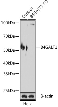 Anti-B4GALT1 Polyclonal Antibody (CAB8546)