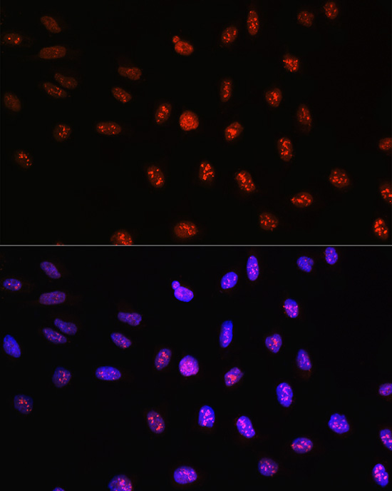 Anti-TCF4 Antibody (CAB1141)