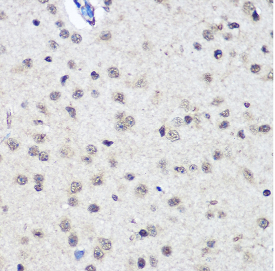 Anti-CTCF Antibody (CAB1133)