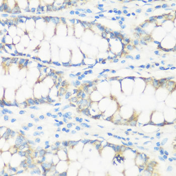 Anti-NMT1 Polyclonal Antibody (CAB8724)