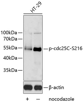 Anti-Phospho-cdc25C-S216 Antibody (CABP0577)