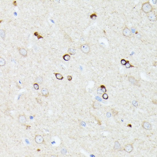 Anti-CCDC6 Antibody (CAB16075)