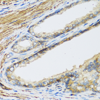 Anti-CSH1 Antibody (CAB1972)