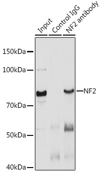 Anti-NF2 Antibody (CAB2456)