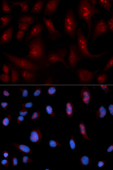 Anti-PLCB1 Antibody (CAB1971)