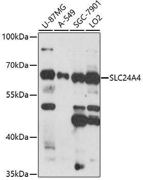 Anti-SLC24A4 Antibody (CAB17254)