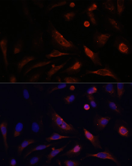 Anti-CLDN5 Antibody (CAB10207)