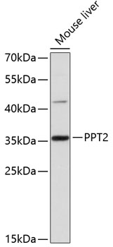 Anti-PPT2 Antibody (CAB12251)