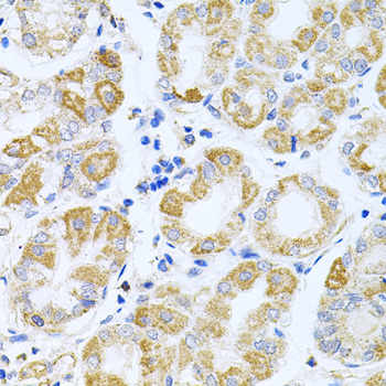 Anti-IRS1 Antibody (CAB0245)