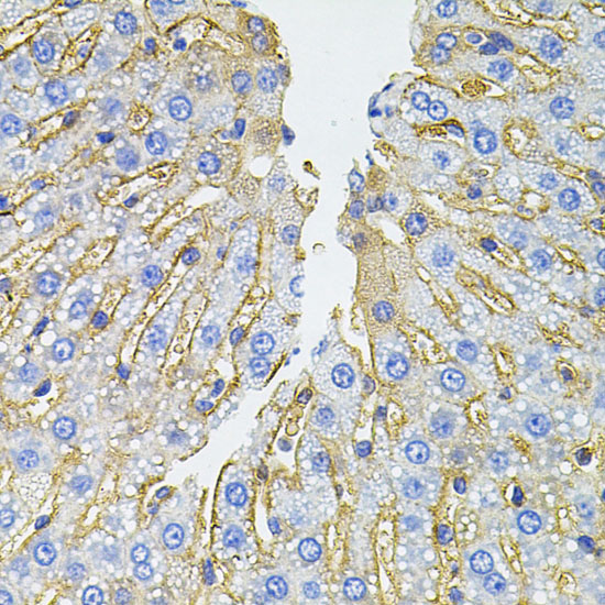 Anti-SLC1A4 Antibody (CAB3084)