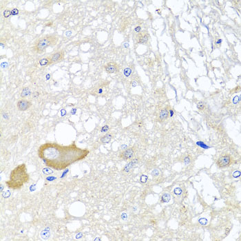 Anti-MCCC2 Polyclonal Antibody (CAB7990)